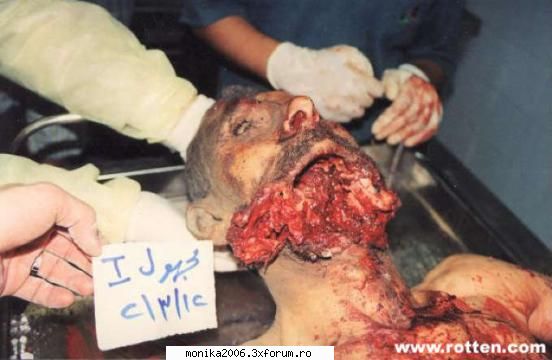 vomitat deja? poze cu cadavre si mortaciuni